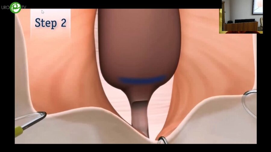 Котов С.В. - Мужской урослинг