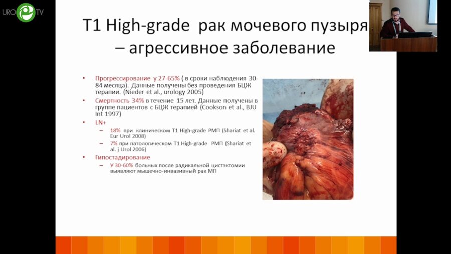 Холтобин Д.П. - Лапароскопическая цистэктомия