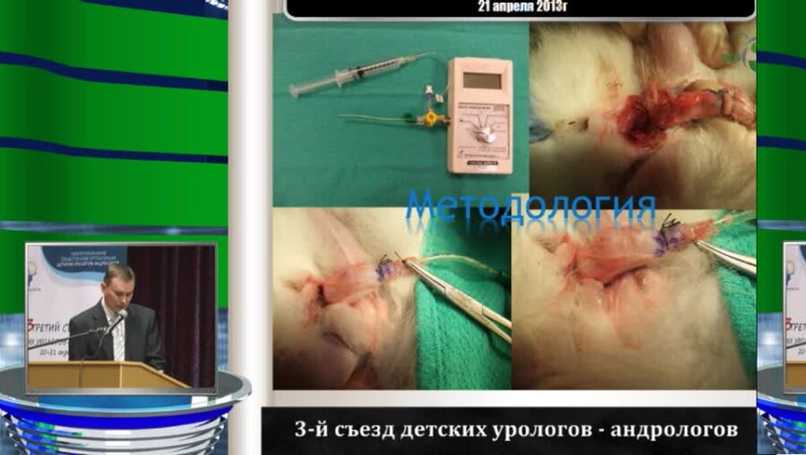 Марченко А.С. "Новая методика прямого измерения степени растяжения и эластичности уретры"