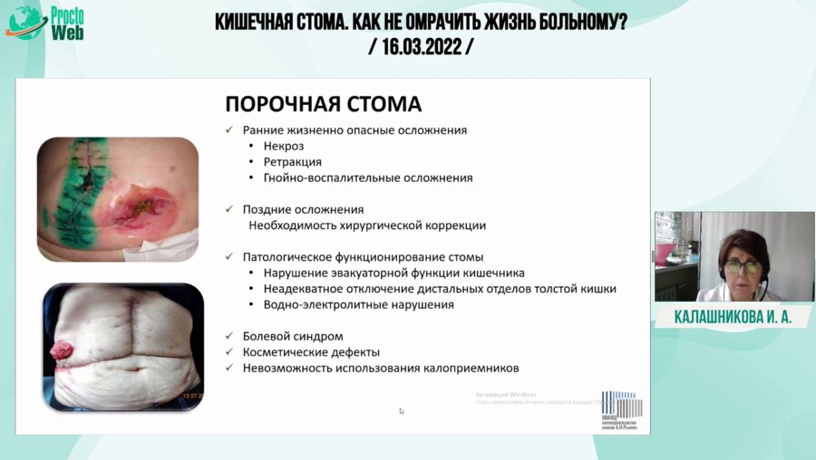 Калашникова И.А. - Как избежать осложнений и трудностей ухода при формировании кишечной стомы