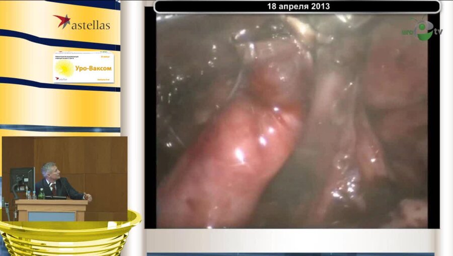 Ю.Э.Рудин "Эндовидеохирургия в детской урологии"