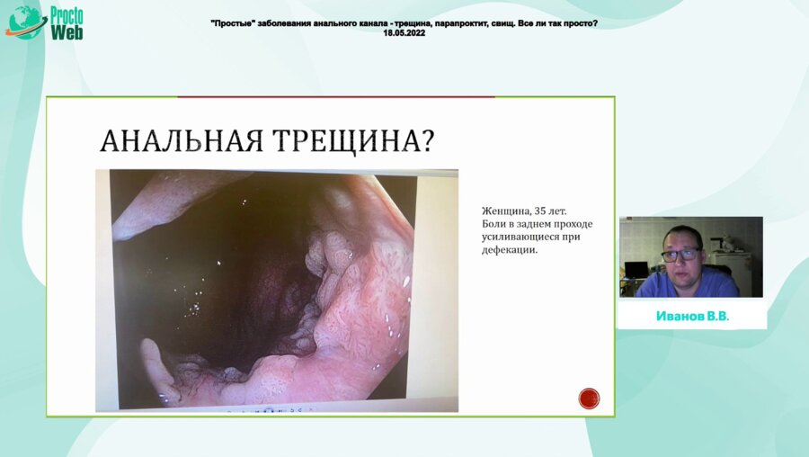 Иванов В.В. - Реальная клиническая практика - как все бывает обманчиво в колопроктологии