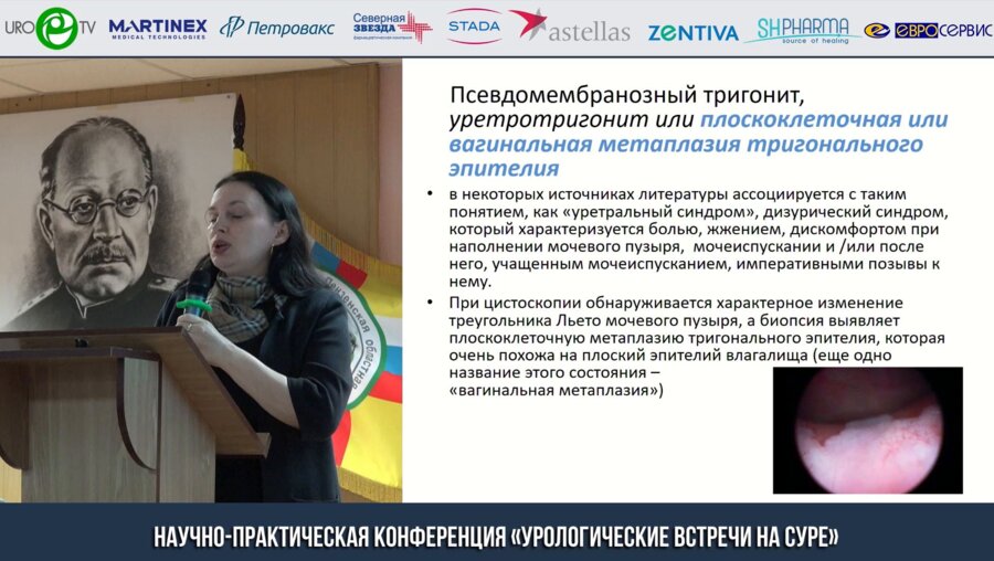 Галкина Н.Г. - Роль вируса папилломы человека в развитии плоскоклеточной метаплазии уротелия