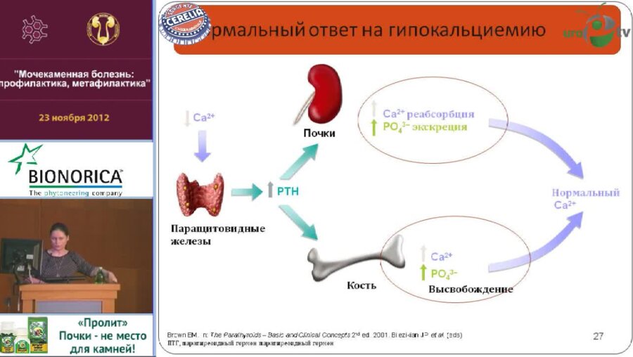 Мокрышева Н.Г. "Нарушение кальций-фосфорного обмена и мочекаменная болезнь"