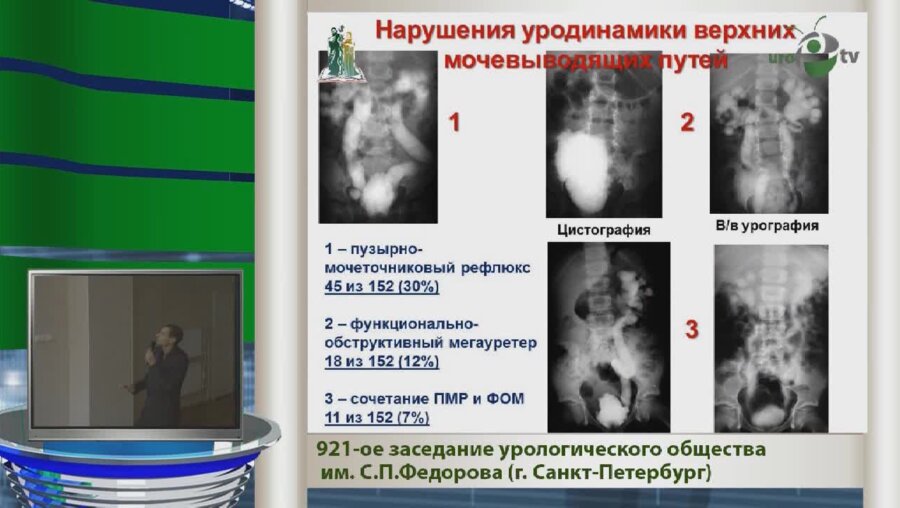 Сарычев С.А. "Хирургическое лечение нарушений резервуарной функции мочевого пузыря у детей с миелодисплазией"