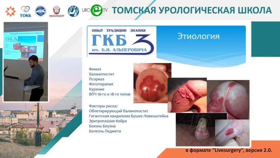 Барабанов А.А. - Реконструктивно-пластические операции при онкологических заболеваниях полового члена