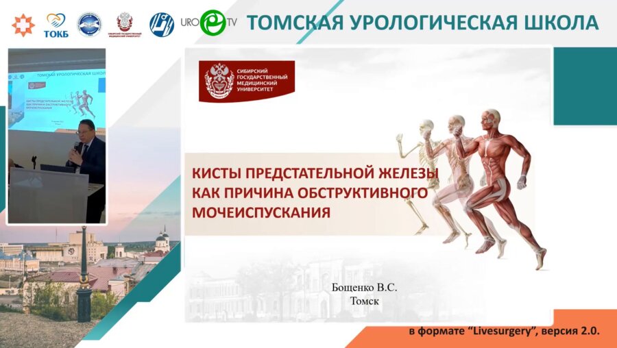 Бощенко В.С. - Кисты предстательной железы как причина обструктивного мочеиспускания