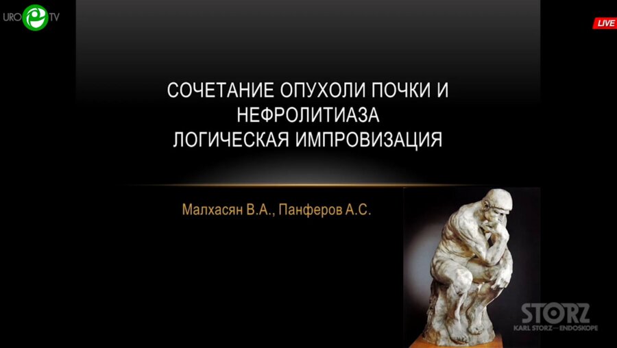 Малхасян В.А. - Сочетание опухоли почки и нефролитиаза. Логическая импровизация