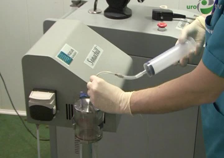 HIFU-терапия предстательной железы