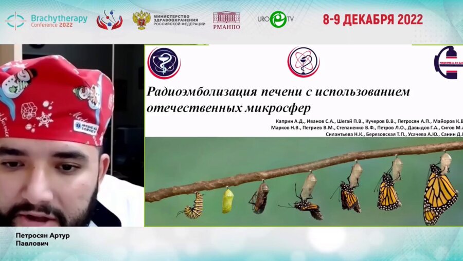 Петросян А.П. - Радиоэмболизация печени с использованием отечественных микросфер