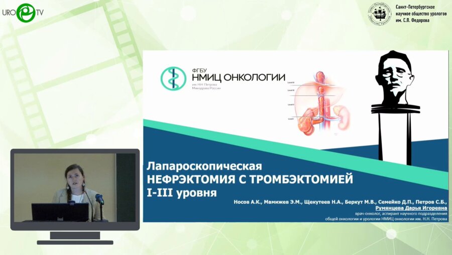 Румянцева Д.И. - Лапароскопическая нефрэктомия с тромбэктомией I-III уровня