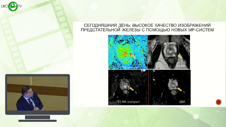 Синицын В.Е. - Современная роль методов лучевой диагностики в стадировании рака предстательной железы