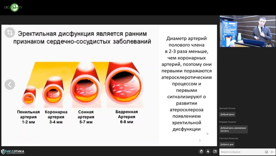 Зырянов А.В. - Гипогонадизм и коморбидные урологические заболевания – эректильная дисфункция, ДГПЖ, хронический рецидивирующий простатит