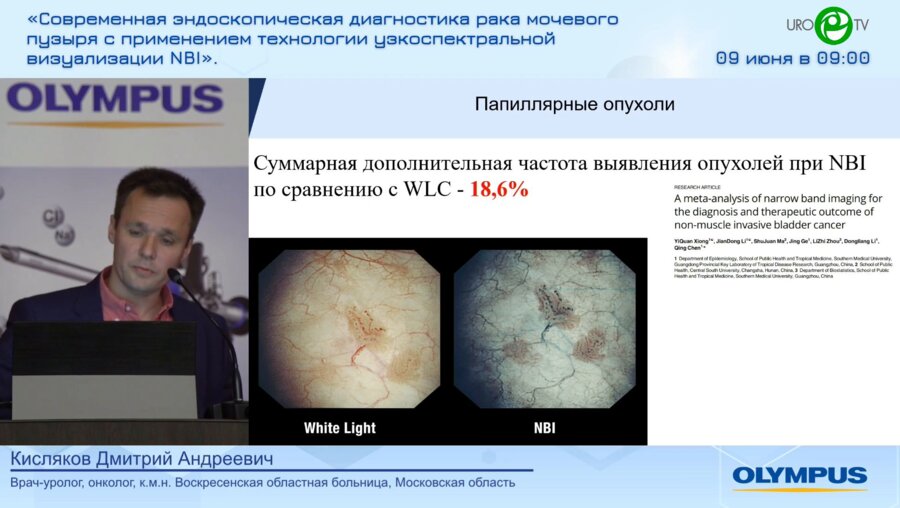 Кисляков Д.А. - За рутинное применение NBI