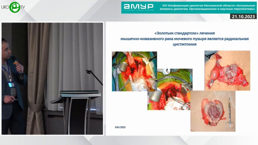 Кешишев Н.Г. - Лапароскопическая цистэктомия. За и Против