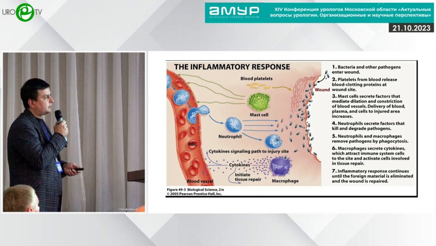 Попов Д. М. - Острое и хроническое воспаление в урологии