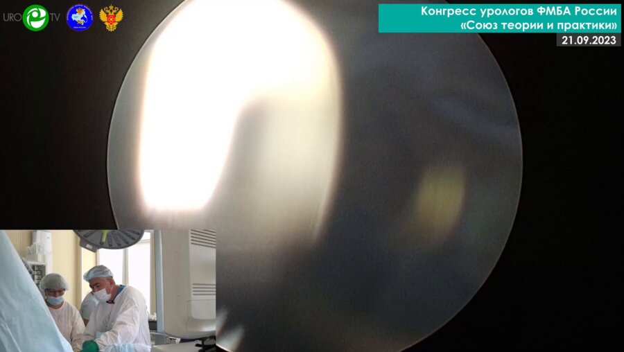 Зарипов М.М. - ТУР МП с ФДТ