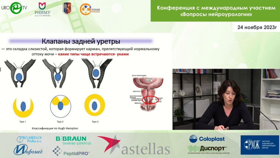 Соттаева З.З. - Клапаны задней уретры у мальчиков