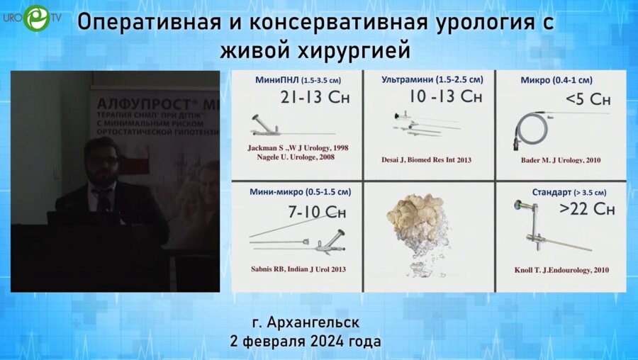 Горелов Д.С. - Камни почек менее 2 см. Какой метод удаления выбрать?