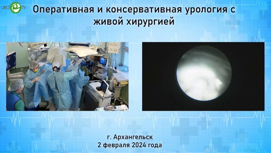 Горелов Д.С. - Уретеролитотрипсия с фиброкаликопиелолитотрипсией