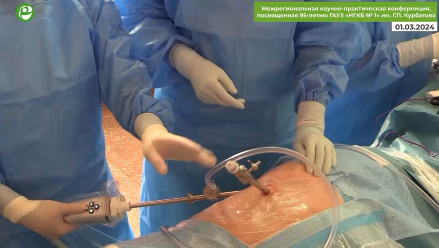 Лебедева А.А. - Люмбоскопическая нефруретерэктомия