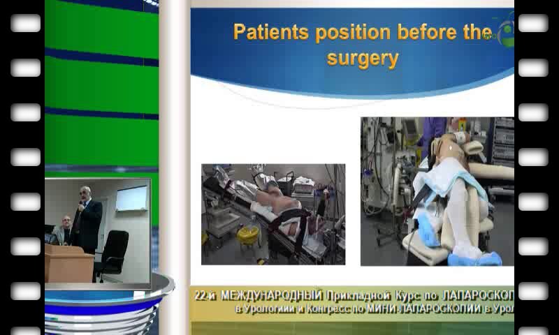 Бактимиров "Осложнения  лапароскопических операций в урологии"