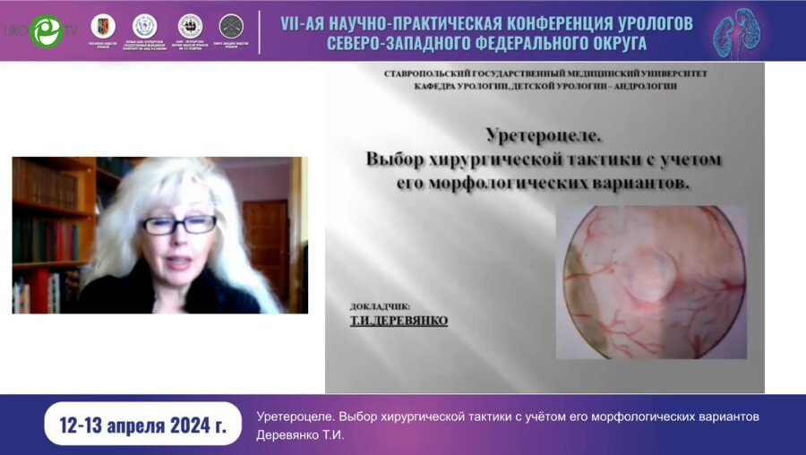 Деревянко Т.И. - Уретероцеле. Выбор хирургической тактики с учётом его морфологических вариантов