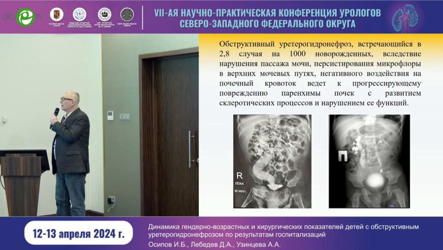 Лебедев Д.А. - Динамика гендерно-возрастных и хирургических показателей детей с обструктивным уретерогидронефрозом