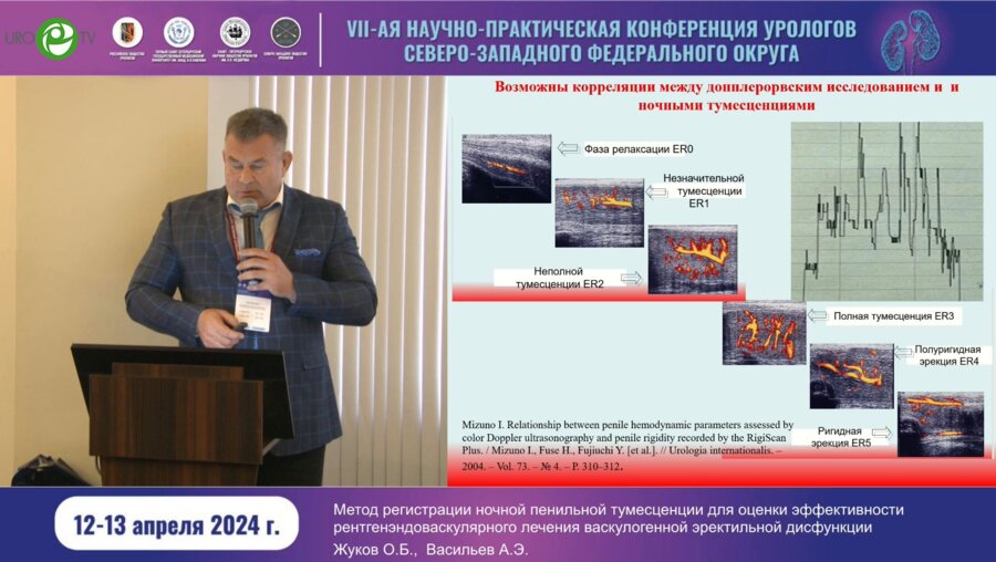 Жуков О.Б. - Метод регистрации ночной пенильной тумесценции для оценки эффективности РЭВ лечения васкулогенной ЭД