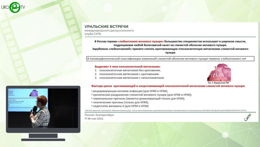 Царева А.В. - Лейкоплакия мочевого пузыря. Контроверсии клинико-морфологического диагноза