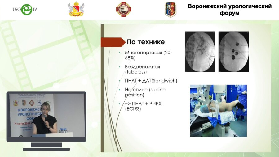 Пилипенко Е.В. - Хирургическое лечение МКБ. Комплексный подход