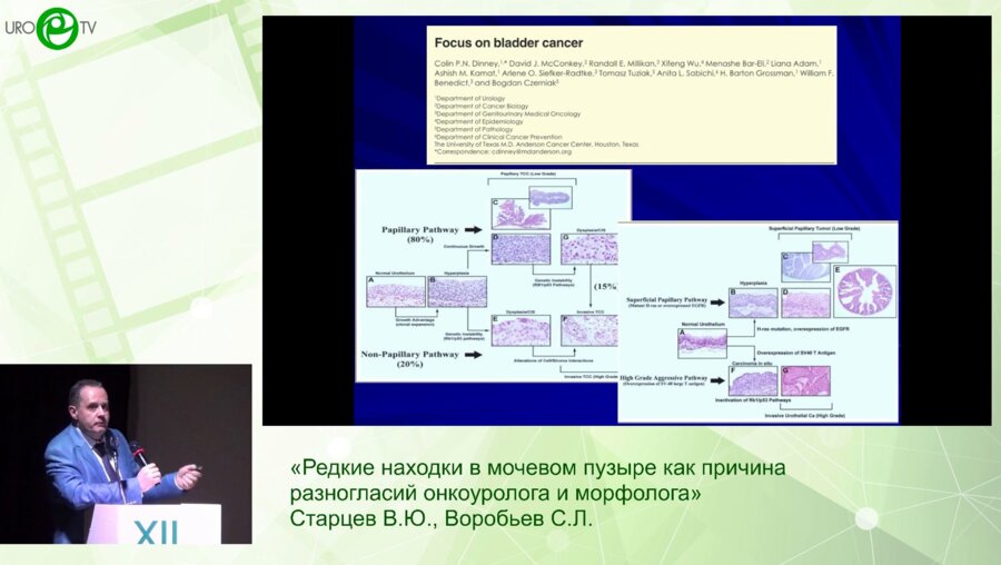 Старцев В.Ю., Воробьев С.Л. - Редкие находки в мочевом пузыре как причина разногласий онкоуролога и морфолога