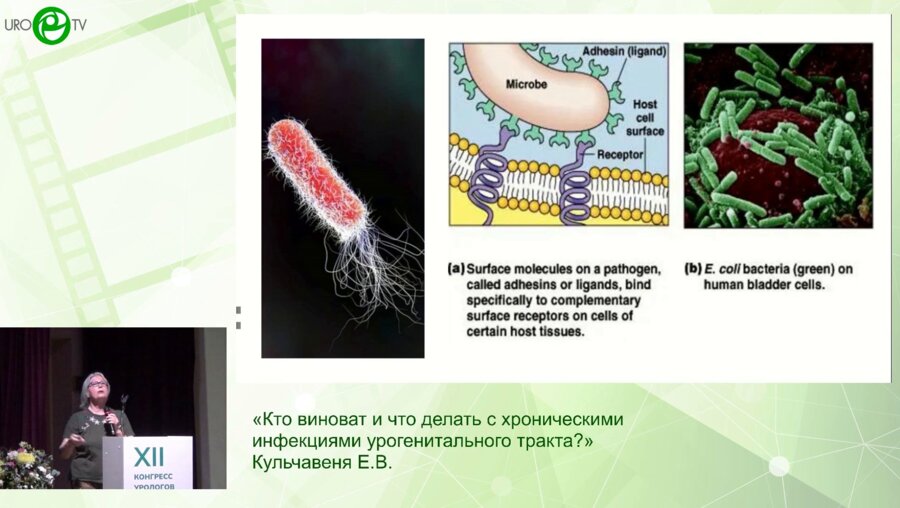 Кульчавеня Е.В. - Кто виноват и что делать с хроническими инфекциями урогенитального тракта