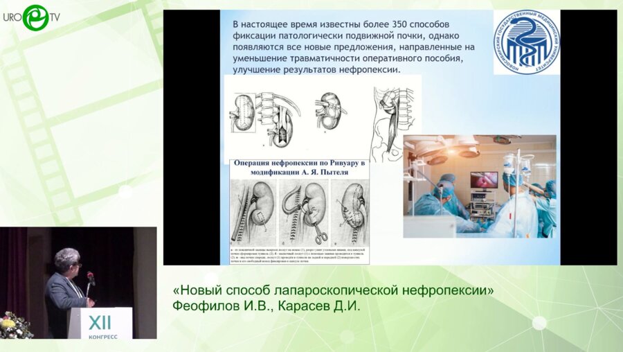 Феофилов И.В., Карасев Д.И. - Новый способ лапароскопической нефропексии