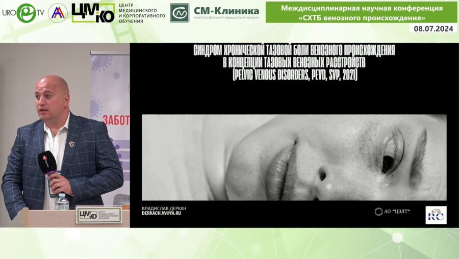 Деркач В.В. - СХТБ венозного происхождения в концепции тазовых венозных расстройств (pelvic venous disorders,PeVD, SVP, 2021)