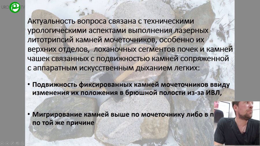 Пилипчук А.А. - Преимущества односторонней интубации при видеоассистированных трансуретральных дроблениях камней МВС