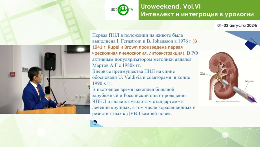 Шубин М.А. - Опыт перкутанной нефролитотрипсии в Сахалинской областной больнице