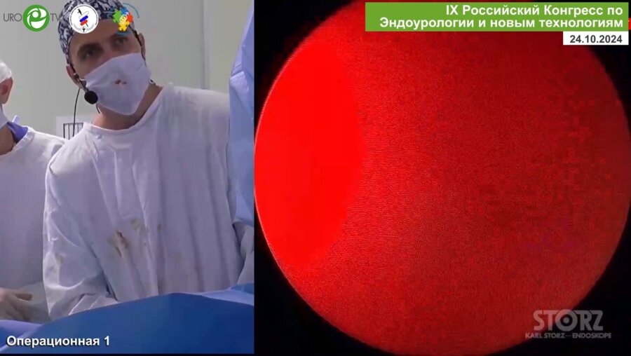 Юнкер А.И., Али С.Х. - ECIRS. Комбинированная перкутанная и трансуретральная лазерная нефролитотрипсия