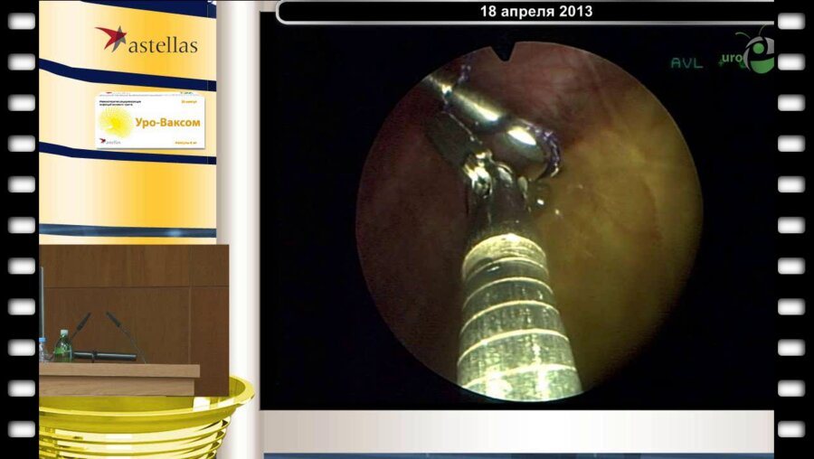 Valla J-S - Пневмовезикоскопические операции в детской урологии (Детская больница Lenval, Ницца, Франция)