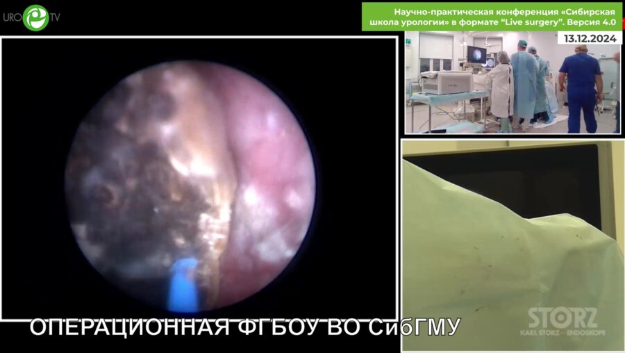 Али С.Х. - ПНЛТ