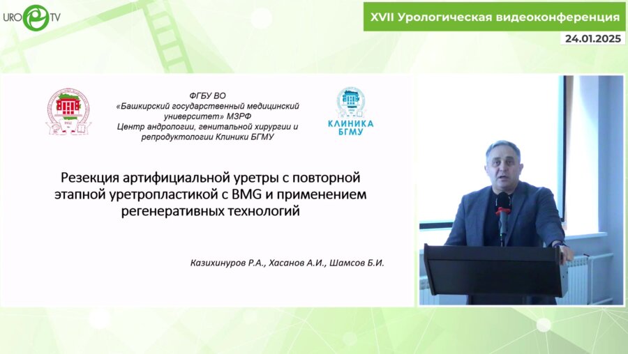 Казихинуров Р.А. - Резекция артифициальной уретры с формированием уретральной площадки из BMG с использованием регенеративных технологий