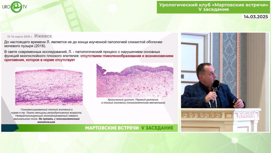Старцев В.Ю. - Современный подход к ведению пациентов с лейкоплакией МП