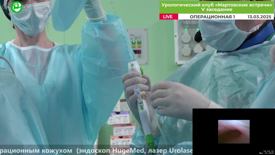 Малхасян В.А. - Ретроградная нефролитотрипсия с аспирационным кожухом (эндоскоп HugeMed, лазер Urolase)