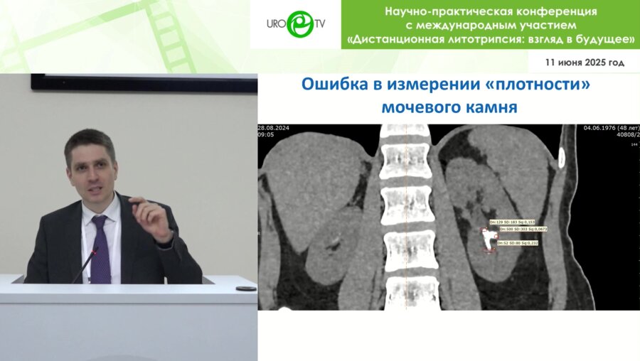 Просянников М.Ю. - Литолитическая терапия МКБ