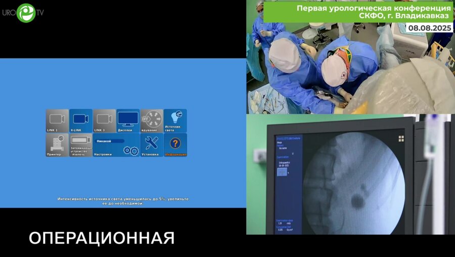Мартов А.Г. - Эндоскопическая комбинированная интраренальная хирургия STORZ