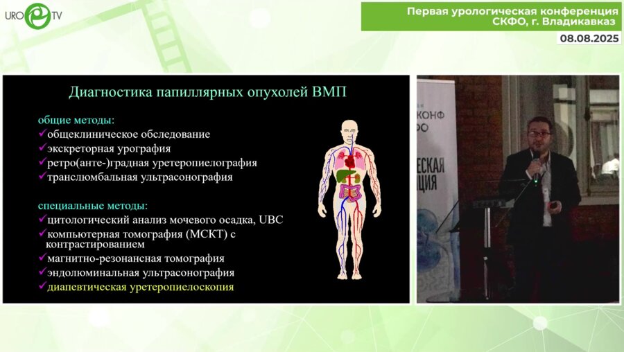 Дутов С.В. - Эндоскопическая диагностика и лечение папиллярных опухолей ВМП