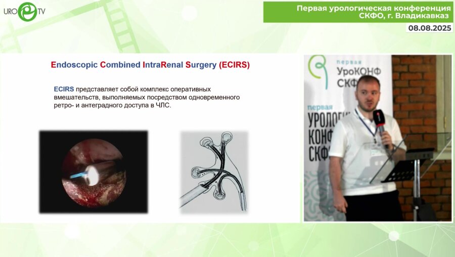 Тохтиев З.Т. - Эндоскопическая комбинированная интраренальная хирургия