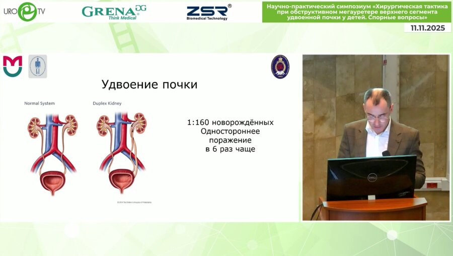 Коварский С.Л. - Органосохраняющие или органоуносящие операции при пороке удвоенных почек