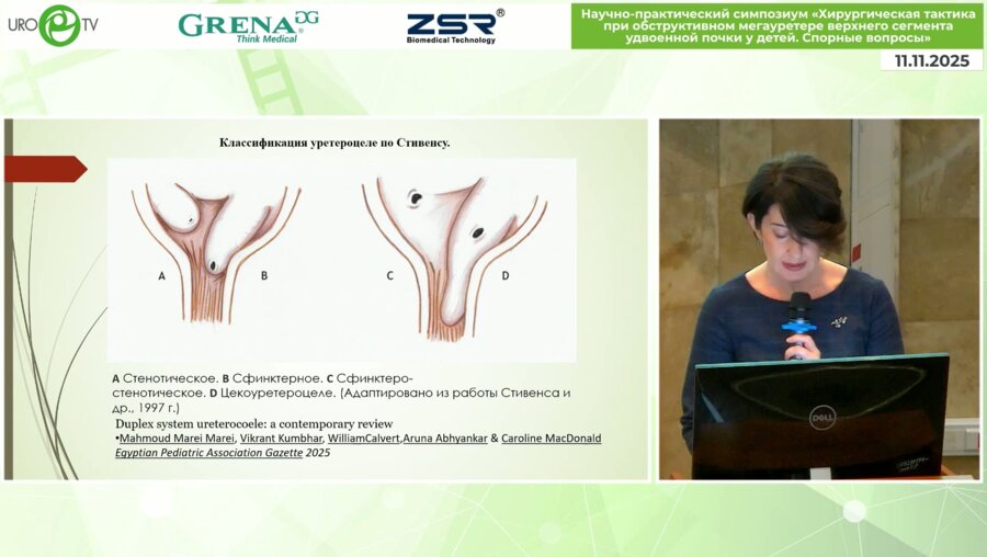 Соттаева З.З. - Современный взгляд на малоинвазивные способы устранения обструкции на фоне уретероцеле при полном удвоении ВМП