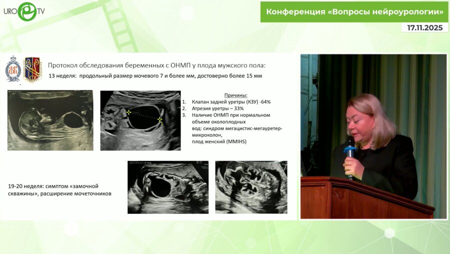 Левитская М.В. - Диагностика и лечение детей с клапаном задней уретры в анте и неонатальном  периоде